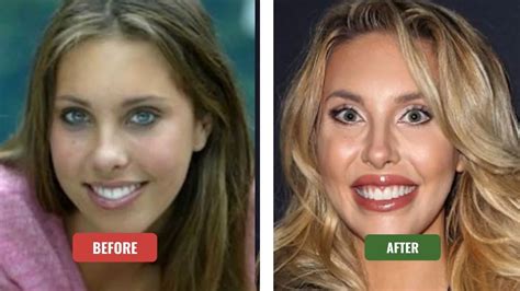 chloe lattanzi tits|Chloe Lattanzis plastic surgery transformation